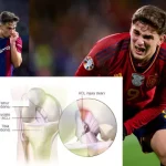 Penanganan Cedera Ligamen Anterior Cruciate Ligament (ACL)